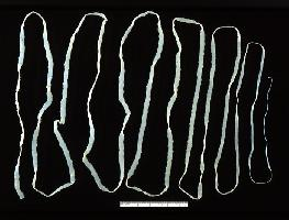 Foto: Beef tapeworm